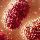 Sexo, erupções cutâneas e surtos: um guia racional para o risco de varíola símia na Califórnia