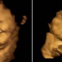 Incríveis imagens de estudo de bebês respondendo ao gosto de couve no útero