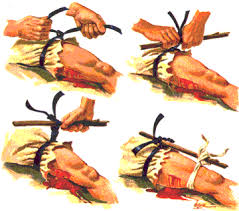 torniquete formas